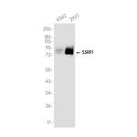 SSRP1 Recombinant Rabbit Monoclonal Antibody (K01_3K57)