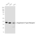 AGTR2 Recombinant Rabbit Monoclonal Antibody (K01_3K58)