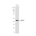 MST3 Recombinant Rabbit Monoclonal Antibody (K01_3K65)