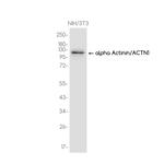 alpha Actinin 1 Recombinant Rabbit Monoclonal Antibody (K01_3K67)