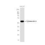 Cytokeratin 6 Recombinant Rabbit Monoclonal Antibody (K01_3K77)