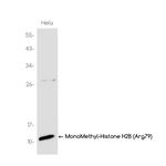 H2BR79me1 Recombinant Rabbit Monoclonal Antibody (K01_3K79)
