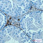 PRAME Recombinant Rabbit Monoclonal Antibody (K01_3K93)