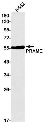 PRAME Antibody in Western Blot (WB)