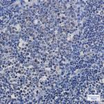 TAF15 Antibody in Immunohistochemistry (Paraffin) (IHC (P))