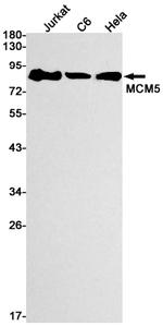 MCM5 Antibody in Western Blot (WB)