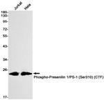 Phospho-Presenilin 1 (Ser310) Recombinant Rabbit Monoclonal Antibody (K01_3L08)
