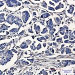 ATE1 Recombinant Rabbit Monoclonal Antibody (K01_3L14)