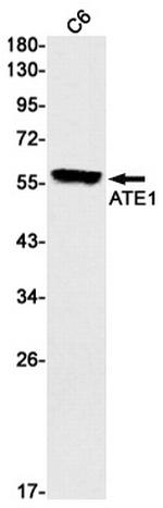 ATE1 Antibody in Western Blot (WB)