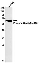 Phospho-Cdc6 (Ser106) Recombinant Rabbit Monoclonal Antibody (K01_3L22)