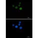 CHK2 Recombinant Rabbit Monoclonal Antibody (K01_3L23)