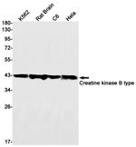 Creatine Kinase BB Antibody in Western Blot (WB)
