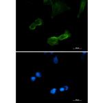 DCLK1 Recombinant Rabbit Monoclonal Antibody (K01_3L32)