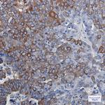 DCLK1 Antibody in Immunohistochemistry (Paraffin) (IHC (P))