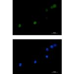 DKC1 Recombinant Rabbit Monoclonal Antibody (K01_3L33)
