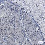 DKC1 Antibody in Immunohistochemistry (Paraffin) (IHC (P))