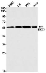 DKC1 Antibody in Western Blot (WB)