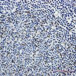 LAT Recombinant Rabbit Monoclonal Antibody (K01_3L46)