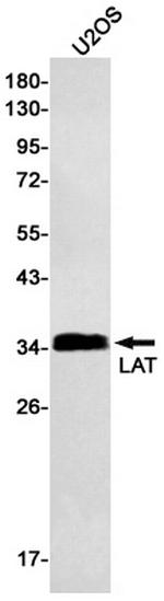 LAT Antibody in Western Blot (WB)