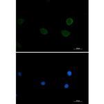 RPS6KB2 Antibody in Immunocytochemistry (ICC/IF)