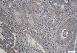RPS6KB2 Antibody in Immunohistochemistry (Paraffin) (IHC (P))