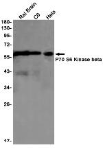 RPS6KB2 Antibody in Western Blot (WB)