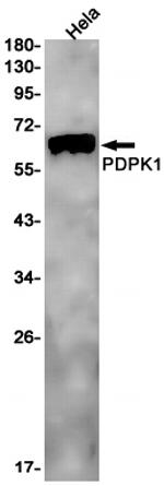 PDPK1 Recombinant Rabbit Monoclonal Antibody (K01_3L55)