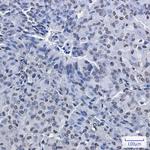 PRMT1 Recombinant Rabbit Monoclonal Antibody (K01_3L62)