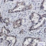 PSMB10 Antibody in Immunohistochemistry (Paraffin) (IHC (P))