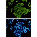 Cofilin Recombinant Rabbit Monoclonal Antibody (K01_3L80)
