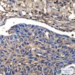 Cofilin Antibody in Immunohistochemistry (Paraffin) (IHC (P))
