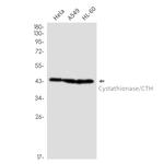 CTH Recombinant Rabbit Monoclonal Antibody (K01_3L81)
