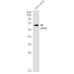 GRK6 Antibody in Western Blot (WB)