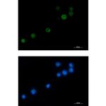 MCAK Recombinant Rabbit Monoclonal Antibody (K01_3L87)