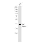 PAR4 Antibody in Western Blot (WB)