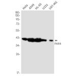 PAR4 Recombinant Rabbit Monoclonal Antibody (K01_3L90)