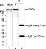 CHD4 Recombinant Human Monoclonal Antibody (K49015_2C12)