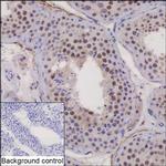 FAM81B Recombinant Mouse Monoclonal Antibody (K40071_18B11)