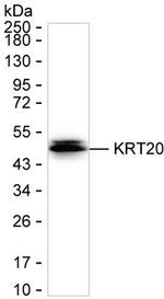 Cytokeratin 20 Recombinant Mouse Monoclonal Antibody (K49028_15E9)