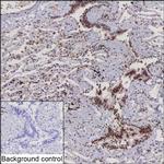 PHF12 Recombinant Mouse Monoclonal Antibody (K8U017_20C4)