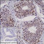 ANKRD26P1 Recombinant Mouse Monoclonal Antibody (K40073_16B3)