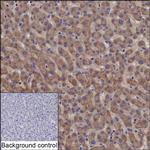 SDSL Recombinant Mouse Monoclonal Antibody (K94053_16H3)