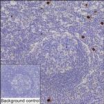 CD122 Recombinant Mouse Monoclonal Antibody (K9N023_10B12)