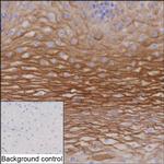 Kallikrein 13 Recombinant Mouse Monoclonal Antibody (K8U022_2G12)