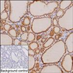 C8orf34 Recombinant Mouse Monoclonal Antibody (K8U017_1F9)