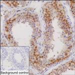 TEX11 Recombinant Mouse Monoclonal Antibody (K94052_6F11)