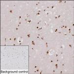 ZBTB49 Recombinant Mouse Monoclonal Antibody (K29068_18A12)