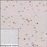 METTL25 Recombinant Mouse Monoclonal Antibody (K1E060_15G6)