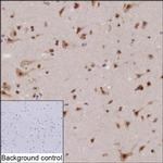 KIAA1755 Recombinant Mouse Monoclonal Antibody (K52071_6D12)