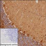 ANKRD20A12P Recombinant Mouse Monoclonal Antibody (K16310_8A11)